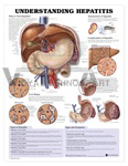 Understanding Hepatitis Anatomical Chart